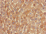 PKD1L1 Antibody - Immunohistochemistry image of paraffin-embedded human liver tissue at a dilution of 1:100