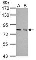 PKG / PRKG1 Antibody - Sample (30 ug of whole cell lysate). A: JC, B: BCL-1. 7.5% SDS PAGE. PKG / PRKG1 antibody diluted at 1:10000.