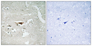 PKIB Antibody - Immunohistochemistry analysis of paraffin-embedded human brain tissue, using IPKB Antibody. The picture on the right is blocked with the synthesized peptide.
