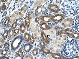 PKLR Antibody - PKLR antibody PKLR(pyruvate kinase, liver and RBC) Antibody was used in IHC to stain formalin-fixed, paraffin-embedded human kidney.  This image was taken for the unconjugated form of this product. Other forms have not been tested.