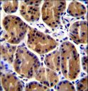 PKP2 / Plakophilin 2 Antibody - PKP2 Antibody immunohistochemistry of formalin-fixed and paraffin-embedded human stomach tissue followed by peroxidase-conjugated secondary antibody and DAB staining.