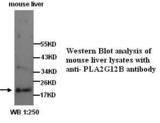 PLA2G12B Antibody