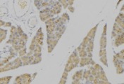 PLA2G2A / SPLA2 Antibody - 1:100 staining human pancreas tissue by IHC-P. The sample was formaldehyde fixed and a heat mediated antigen retrieval step in citrate buffer was performed. The sample was then blocked and incubated with the antibody for 1.5 hours at 22°C. An HRP conjugated goat anti-rabbit antibody was used as the secondary.