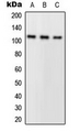 PLA2G4A Antibody - Western blot analysis of PLA2G4A expression in A549 (A); HeLa (B); mouse kidney (C) whole cell lysates.
