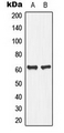 PLA2G4C Antibody - Western blot analysis of PLA2G4C expression in Jurkat (A); human pancreas (B) whole cell lysates.