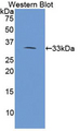 PLA2R / PLA2R1 Antibody - Western Blot; Sample: Recombinant protein.