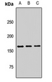 PLA2R / PLA2R1 Antibody