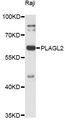 PLAGL2 Antibody - Western blot analysis of extracts of Raji cells, using PLAGL2 antibody at 1:3000 dilution. The secondary antibody used was an HRP Goat Anti-Rabbit IgG (H+L) at 1:10000 dilution. Lysates were loaded 25ug per lane and 3% nonfat dry milk in TBST was used for blocking. An ECL Kit was used for detection and the exposure time was 90s.