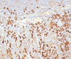 Plasma Cell Antibody - Plasma Cell Marker antibody LIV3G11 immunohistochemistry tonsil.  This image was taken for the unmodified form of this product. Other forms have not been tested.