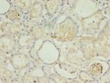 PLCD4 Antibody - Immunohistochemistry of paraffin-embedded human kidney tissue using antibody at 1:100 dilution.  This image was taken for the unconjugated form of this product. Other forms have not been tested.