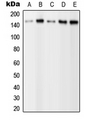 PLCG2 / PLC Gamma 2 Antibody - Western blot analysis of PLC gamma 2 (pY1217) expression in HEK293T EGF-treated (A); A431 (B); NIH3T3 (C); SP2/0 EGF-treated (D); H9C2 EGF-treated (E) whole cell lysates.