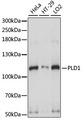 PLD1 / Phospholipase D1 Antibody - Western blot analysis of extracts of various cell lines, using PLD1 antibody at 1:1000 dilution. The secondary antibody used was an HRP Goat Anti-Rabbit IgG (H+L) at 1:10000 dilution. Lysates were loaded 25ug per lane and 3% nonfat dry milk in TBST was used for blocking. An ECL Kit was used for detection and the exposure time was 1s.