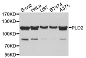 PLD2 / Phospholipase D2 Antibody - Western blot analysis of extracts of various cell lines, using PLD2 antibody at 1:1000 dilution. The secondary antibody used was an HRP Goat Anti-Rabbit IgG (H+L) at 1:10000 dilution. Lysates were loaded 25ug per lane and 3% nonfat dry milk in TBST was used for blocking. An ECL Kit was used for detection and the exposure time was 15s.