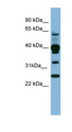 PLEK / Pleckstrin Antibody - PLEK antibody Western blot of Fetal Spleen lysate. This image was taken for the unconjugated form of this product. Other forms have not been tested.