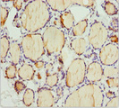 PLEKHA1 Antibody - Immunohistochemistry of paraffin-embedded human thyroid tissue at dilution 1:100