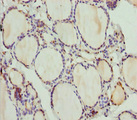 PLEKHA1 Antibody - Immunohistochemistry of paraffin-embedded human thyroid tissue at dilution 1:100