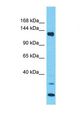 PLEKHA5 Antibody - Western blot of Human NCI-H226. PLEKHA5 antibody dilution 1.0 ug/ml.  This image was taken for the unconjugated form of this product. Other forms have not been tested.