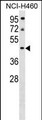 PLEKHA8P1 Antibody - PLEKHA9 Antibody (C-term) western blot analysis in NCI-H460 cell line lysates (35ug/lane).This demonstrates the PLEKHA9 antibody detected the PLEKHA9 protein (arrow).