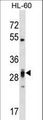 PLEKHF2 Antibody - PLEKHF2 Antibody western blot of HL-60 cell line lysates (35 ug/lane). The PLEKHF2 antibody detected the PLEKHF2 protein (arrow).