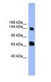 PLEKHG2 Antibody - PLEKHG2 antibody Western Blot of Fetal Heart.  This image was taken for the unconjugated form of this product. Other forms have not been tested.