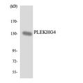 PLEKHG4 Antibody - Western blot analysis of the lysates from HUVECcells using PLEKHG4 antibody.