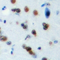 PLEKHG4 Antibody - Immunohistochemical analysis of PLEKHG4 staining in human brain formalin fixed paraffin embedded tissue section. The section was pre-treated using heat mediated antigen retrieval with sodium citrate buffer (pH 6.0). The section was then incubated with the antibody at room temperature and detected using an HRP polymer system. DAB was used as the chromogen. The section was then counterstained with hematoxylin and mounted with DPX.