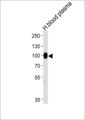 PLG / Plasmin / Plasminogen Antibody - Western blot of lysate from human blood plasma tissue lysate, using PLG Antibody. Antibody was diluted at 1:1000 at each lane. A goat anti-rabbit IgG H&L (HRP) at 1:5000 dilution was used as the secondary antibody. Lysate at 35ug per lane.