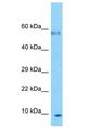 PLGLB2 / PLGLB1 Antibody - PLGLB2 / PLGLB1 antibody Western Blot of U937. Antibody dilution: 1 ug/ml.  This image was taken for the unconjugated form of this product. Other forms have not been tested.