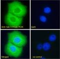 PLK4 / SAK Antibody - Sak / STK18 / PLK4 Antibody Immunofluorescence analysis of paraformaldehyde fixed A431 cells, permeabilized with 0.15% Triton. Primary incubation 1hr (10ug/ml) followed by Alexa Fluor 488 secondary antibody (2ug/ml), showing cytoplasmic staining. The nuclear stain is DAPI (blue). Negative control: Unimmunized goat IgG (10ug/ml) followed by Alexa Fluor 488 secondary antibody (2ug/ml).