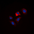 PLN / Phospholamban Antibody - Immunofluorescent analysis of Phospholamban (pS16/T17) staining in HUVEC cells. Formalin-fixed cells were permeabilized with 0.1% Triton X-100 in TBS for 5-10 minutes and blocked with 3% BSA-PBS for 30 minutes at room temperature. Cells were probed with the primary antibody in 3% BSA-PBS and incubated overnight at 4 deg C in a humidified chamber. Cells were washed with PBST and incubated with a DyLight 594-conjugated secondary antibody (red) in PBS at room temperature in the dark. DAPI was used to stain the cell nuclei (blue).