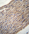 PLOD / PLOD1 Antibody - PLOD1 Antibody immunohistochemistry of formalin-fixed and paraffin-embedded human heart tissue followed by peroxidase-conjugated secondary antibody and DAB staining.