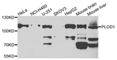 PLOD / PLOD1 Antibody - Western blot analysis of extracts of various cells.