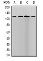 PLOD / PLOD1 Antibody - Western blot analysis of LLH expression in SKOV3 (A); HepG2 (B); mouse brain (C); mouse liver (D) whole cell lysates.