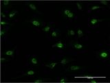 PLRG1 Antibody - Immunofluorescence of monoclonal antibody to PLRG1 on HeLa cell . [antibody concentration 10 ug/ml]