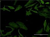 PLS3 / T Plastin Antibody - Immunofluorescence of monoclonal antibody to PLS3 on HeLa cell . [antibody concentration 10 ug/ml]