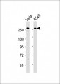 PLXNB1 / Plexin-B1 Antibody - All lanes : Anti-PLXNB1 Antibody at 1:2000 dilution Lane 1: HeLa whole cell lysates Lane 2: A549 whole cell lysates Lysates/proteins at 20 ug per lane. Secondary Goat Anti-Rabbit IgG, (H+L), Peroxidase conjugated at 1/10000 dilution Predicted band size : 232 kDa Blocking/Dilution buffer: 5% NFDM/TBST.