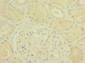 PLXNB2 / Plexin B2 Antibody - Immunohistochemistry of paraffin-embedded human kidney tissue at dilution 1:100