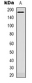 PLXNC1 / Plexin C1 Antibody - Western blot analysis of CD232 expression in NIH3T3 (A) whole cell lysates.