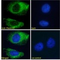 PLXND1 / Plexin D1 Antibody - PLXND1 / Plexin D1 antibody immunofluorescence analysis of paraformaldehyde fixed HeLa cells, permeabilized with 0.15% Triton. Primary incubation 1hr (10ug/ml) followed by Alexa Fluor 488 secondary antibody (2ug/ml), showing membrane/cytoplasmic staining. The nuclear stain is DAPI (blue). Negative control: Unimmunized goat IgG (10ug/ml) followed by Alexa Fluor 488 secondary antibody (2ug/ml).