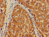 PLXND1 / Plexin D1 Antibody - Immunohistochemistry of paraffin-embedded human liver tissue at dilution of 1:100