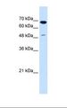 PMEL / SILV / gp100 Antibody - HepG2 cell lysate. Antibody concentration: 1.25 ug/ml. Gel concentration: 12%.  This image was taken for the unconjugated form of this product. Other forms have not been tested.