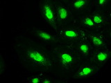 PMEL / SILV / gp100 Antibody - Immunofluorescent staining of A549 cells using anti-SILV mouse monoclonal antibody.