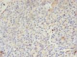 PMM1 Antibody - Immunohistochemistry of paraffin-embedded human pancreas tissue using antibody at 1:100 dilution.  This image was taken for the unconjugated form of this product. Other forms have not been tested.