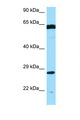 PMM2 Antibody - PMM2 antibody Western blot of MCF7 Cell lysate. Antibody concentration 1 ug/ml.  This image was taken for the unconjugated form of this product. Other forms have not been tested.