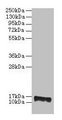 PMP2 / FABP8 Antibody - Western blot All lane: Cytidine deaminase antibody at 2µg/ml + EC109 whole cell lysate Secondary Goat polyclonal to rabbit IgG at 1/15000 dilution Predicted band size: 14.5 kDa Observed band size: 14.5 kDa