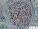 PMP22 Antibody - PMP22 staining in human paraffin embedded formalin fixed nerve section. Peripheral nerve myelin sheats are stained with monoclonal antibody CF1