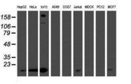 PMVK Antibody - Western blot of extracts (35 ug) from 9 different cell lines by using g anti-PMVK monoclonal antibody (HepG2: human; HeLa: human; SVT2: mouse; A549: human; COS7: monkey; Jurkat: human; MDCK: canine; PC12: rat; MCF7: human).