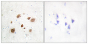 PNCK / CaMK1b Antibody - Immunohistochemistry analysis of paraffin-embedded human brain tissue, using CaMK1-beta Antibody. The picture on the right is blocked with the synthesized peptide.