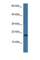 PNKD Antibody - PNKD antibody Western blot of Mouse Heart lysate. Antibody concentration 1 ug/ml. This image was taken for the unconjugated form of this product. Other forms have not been tested.