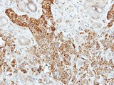 PNLIP / PL / Pancreatic Lipase Antibody - IHC of paraffin-embedded SCM-1 xenograft using Pancreatic Lipase antibody at 1:500 dilution.